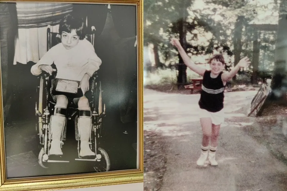 Bobby Digan, before and after he received a healing at St. Faustina's shrine in Poland in 1981. Photos courtesy of Bob & Maureen Digan