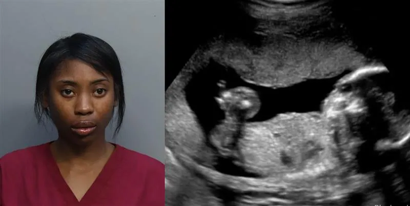 Natalia Harrell, 24, who is being held in in a Miami Dade correctional facility, is arguing that her unborn child is being unlawfully held in custody.?w=200&h=150