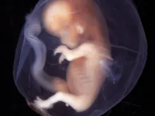 An embryo, between 9-10 weeks of pregnancy